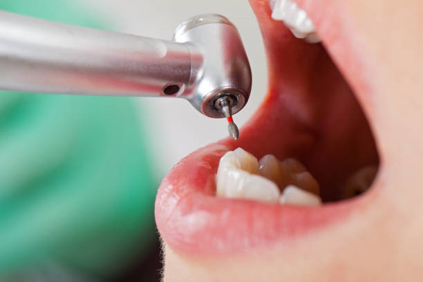 Best Emergency Treatment for Oral Infections in Florin, CA